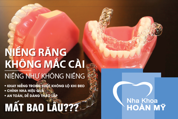 niềng răng không mắc cài tại quận Hải An Hải Phòng