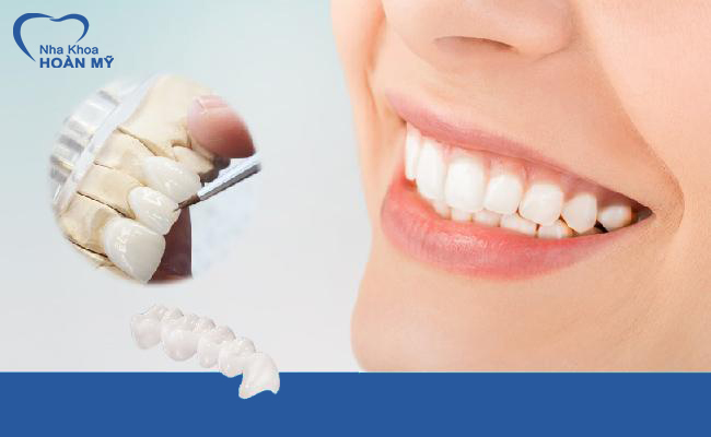 Bọc răng sứ ở hải phòng với răng sứ kim loại