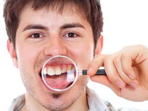 Khi nào nên bọc sứ răng cửa tại Hải Phòng?