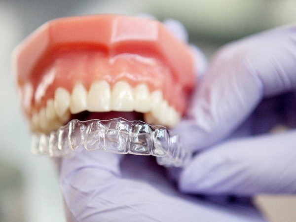Niềng răng trong suốt Hải Phòng không cần đến nha khoa thường xuyên 